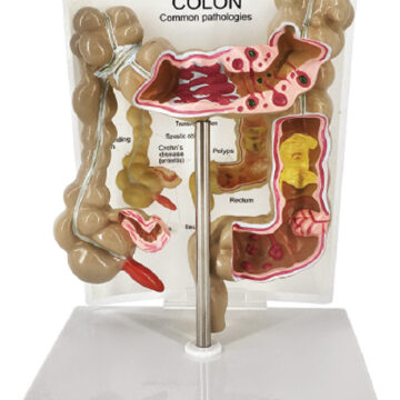 Pathological Model of Colon and Rectum, Half Size