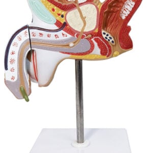 Pathological Model of the Male Urogenital System, Life Size, 2 Parts