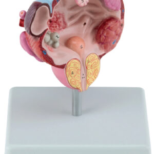 Pathological Model of Bladder and Prostate Gland