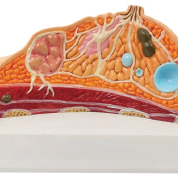 Pathological Model of Breast
