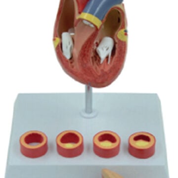 Heart Model with Blood Clot, 6 Parts