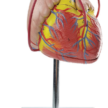 Heart with Bypass, Life Size, 2 Parts