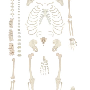 Disarticulated Skeleton with Skull