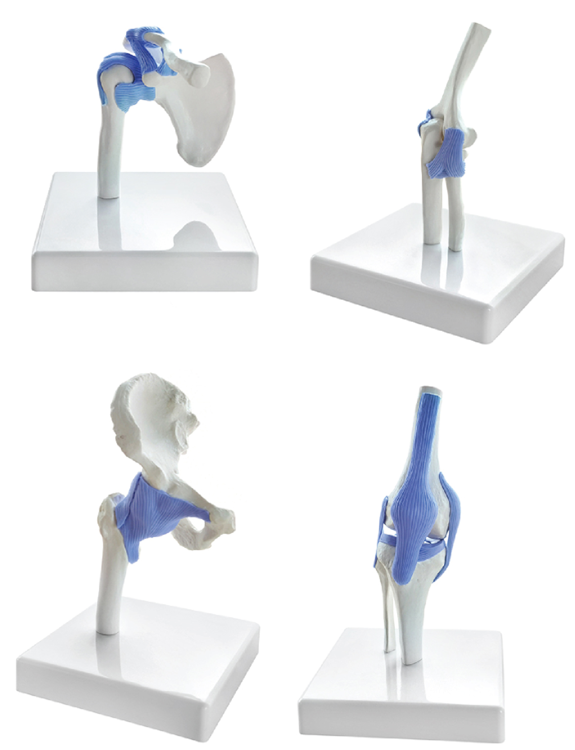 DS-60214 - Miniature Hip, Elbow, Shoulder and Knee Joint Set, Half Size, 4 Parts Miniature Hip, Elbow, Shoulder and Knee Joint Set, Half Size, 4 Parts