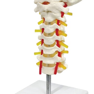 Cervical Spine with Brainstem & Arteries