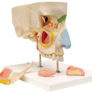 Nose with Paranasal Sinuses(3x Enlarged), 5 Parts
