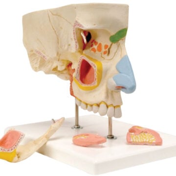 Nose with Paranasal Sinuses(3x Enlarged), 5 Parts
