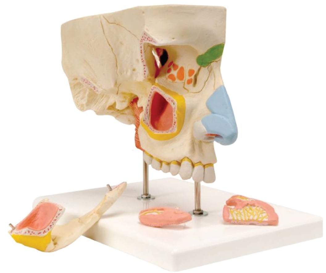 DS-60515 - Nose with Paranasal Sinuses(3x Enlarged), 5 Parts Nose with Paranasal Sinuses(3x Enlarged), 5 Parts