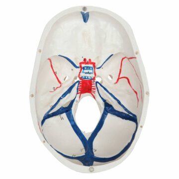 Skull with Painted Endocranial BloodVessel, Life Size, 3 Parts