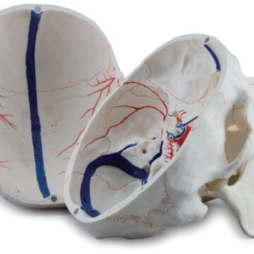 Skull with Painted Endocranial BloodVessel, Life Size, 3 Parts