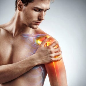 Shoulder Impingement Recovery — What, Why, And How